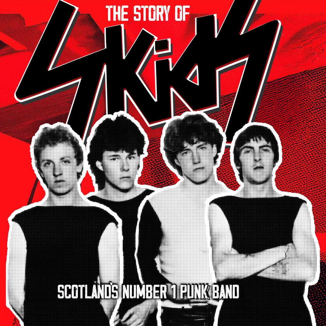 The Story of Skids – Film Review